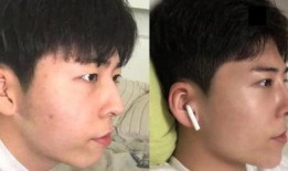 整形爆料视频大全最新,网红整形视频大全大揭秘